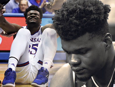 أودوكا أصيب في كاحله